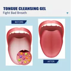 Gel nettoyant de la langue pour prévenir les mauvaises Haleine